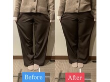 ナオル整体 宮崎院(NAORU整体)/20代女性施術事例【O脚改善】