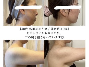 ヨサパーク サナ 二子玉川(YOSA PARK SANA)の写真/二の腕集中でハミ肉もたるみもスッキリ改善！体幹から脂肪を燃焼し、リンパマッサージで老廃物の排出促進！