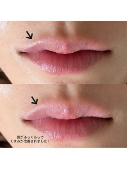 エミュ(e'mu)/くちびるまで徹底ケア!