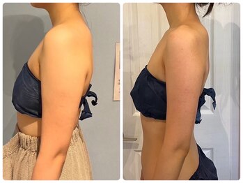 ルナグランデ 心斎橋店(Luna grande.)/厚みを減らす