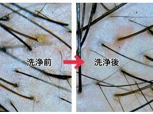 スーパースカルプ 大津店(SuperScalp)の雰囲気（頭髪のプロによるヘッドスパ）