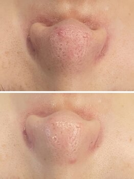 オレアグリーン 岡崎(OLEA green)/