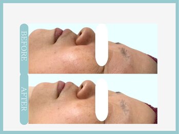 アコガレコガオ 八戸店/