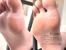 エクリュ(ecru)/南国市　フット　ケア