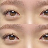 ヨーク トゥルペ(yorke tulpe)