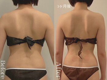 ユーフォリア グロウ(euphoria glow)/{ ラフォス痩身90分 10回 }