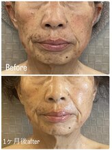 アリィ(Alii)/何歳からでも変われる施術