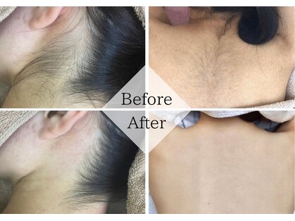 アルゴ 熊本宇土店(ALGO)の写真