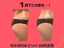 美方/上半身セルゼロ集中コース