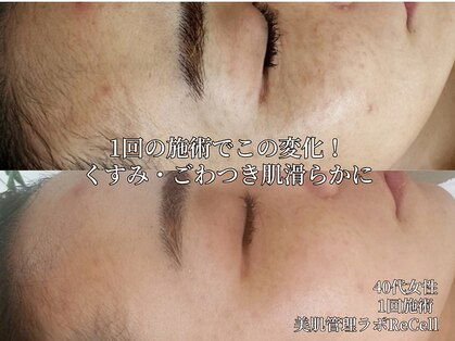 リセル 月島(ReCeLL)の写真