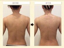 ミエル(Miel)/Before After