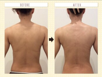 ミエル(Miel)/Before After