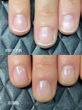 クーラ アンド ベリッシモ(Cura&Bellissimo)&nbsp;丸爪 平爪 貝爪