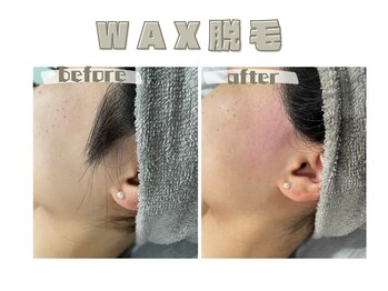 レヴィート(Revept)/【ワックス脱毛】