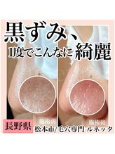 ルネッタ(Lunetta)/