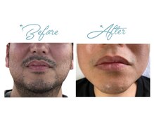 キレミカ 名取店