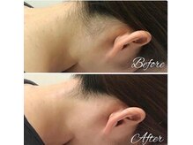 ザエステ 赤坂店(The Esthe.)