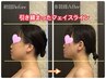 【スピード変化】小顔キャビテーション×毛穴の開き/黒ずみ撃退¥15000→¥9800