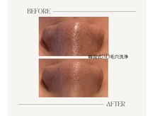 サロンアールミヨン(Salon R Miyon)/韓国式3D毛穴洗浄