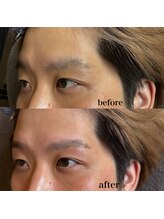 トップルック 横浜店(TOP LOOK)/眉毛ビフォーアフター