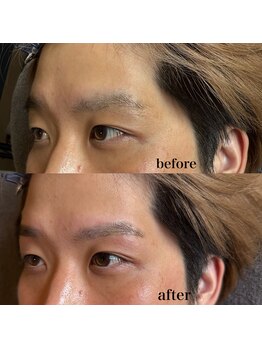 トップルック 横浜店(TOP LOOK)/眉毛ビフォーアフター