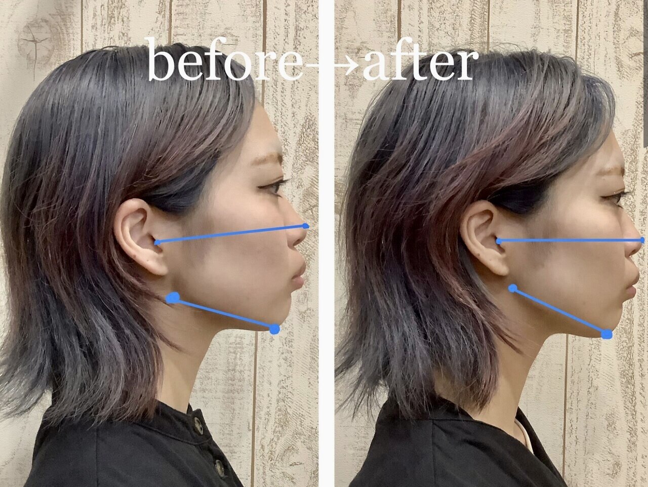 フォト｜スピード小顔 渋谷店 (Speed)｜ホットペッパービューティー