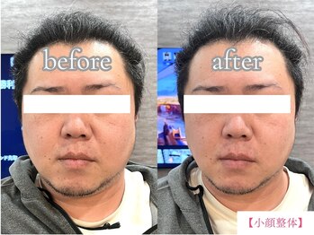 ボディメイク アールエフ サクラ接骨院(bodymake RF SAKURA接骨院)/小顔矯正