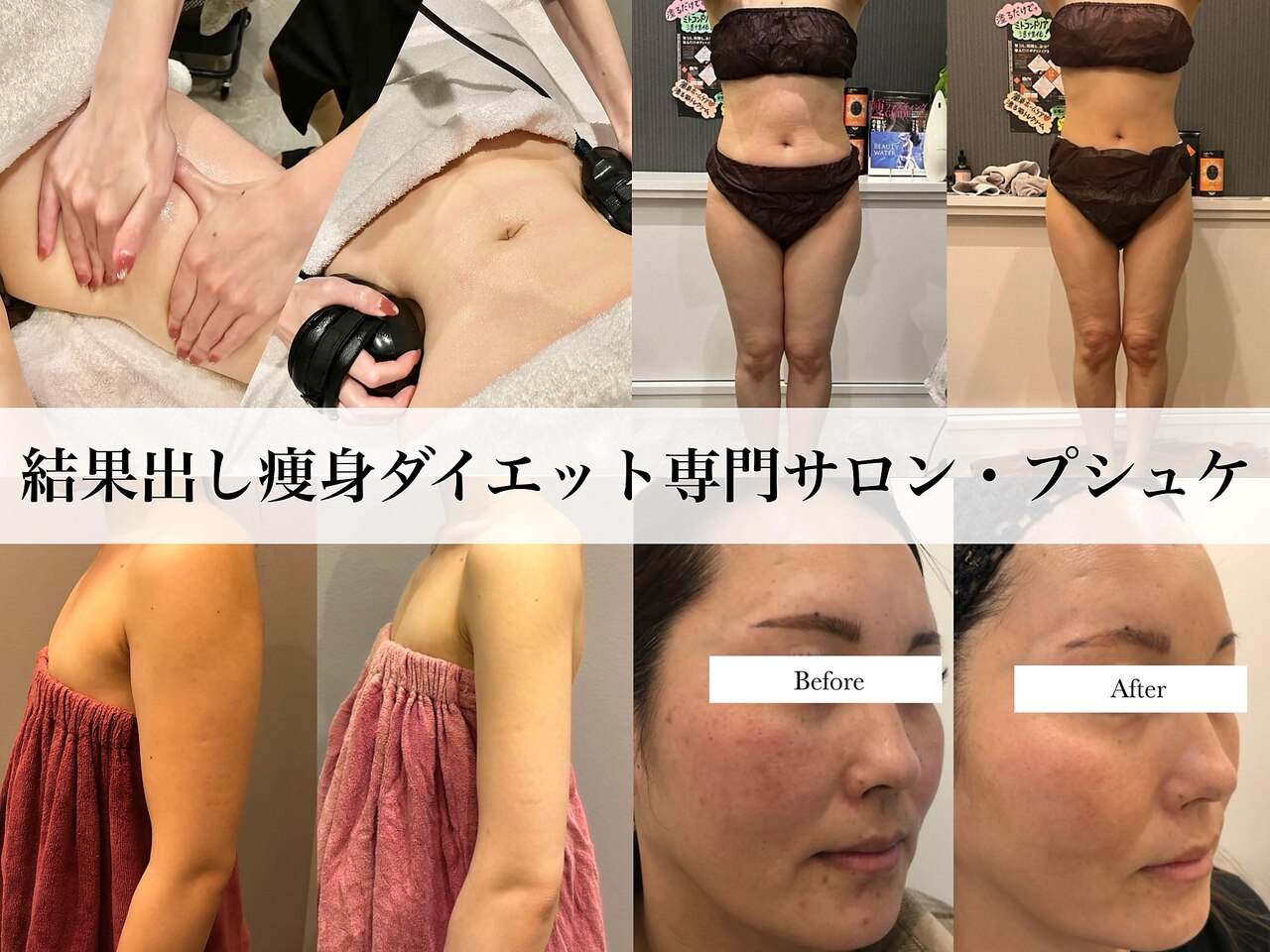 伊勢崎市でVIO脱毛が人気のエステサロン|ホットペッパービューティー 伊勢崎市でVIO脱毛が人気のエステサロン|ホットペッパービューティー