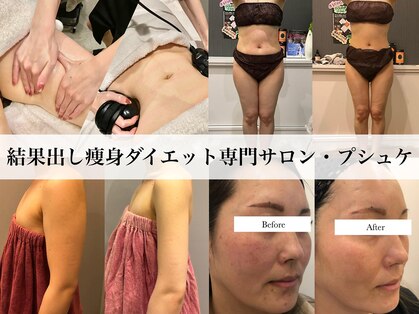 プシュケ(PSYCHE)の写真