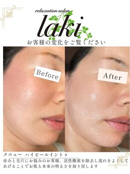 リラクゼーションサロン ラキ(laki)/ハイピールイントゥ