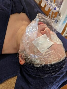 リリー(lily)/フェイシャルエステ