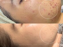 シェステ ゴジュウヨン(shesthe54)/before／after