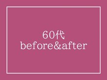 アクアビー(AQUA-B)/