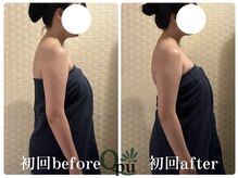 キュープ 福岡天神店(Qpu)/巻き肩コース１回での変化