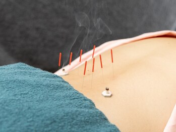 鍼按堂/はり・きゅう