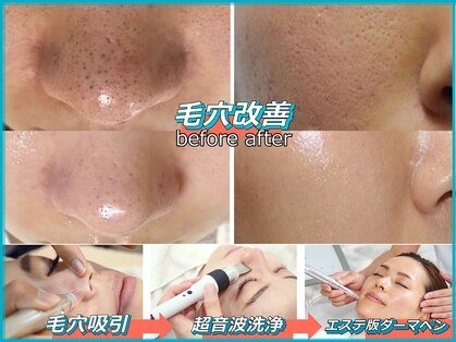 パルテールの写真