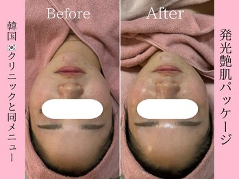 エンクリニカルラボ 三宮店(E&N CLINICAL LABO)/発光艶肌パッケージ☆日本初！