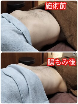 シャルールプラス(chaleurplus)/hot腸もみ90分後