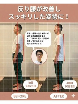 のなか整体院/整体 Before→After