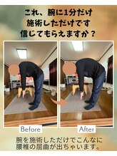 エヌキュア(N Cure)/ビフォーアフター