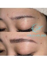 シャロンドットエイチエム(CHALON.HM)/アイブロウリフト