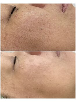 プリマプリート 大垣店/FaceWAX