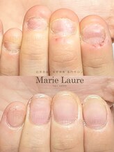 マリーロール 天王寺店(Marie Laure)/深爪矯正/自爪育成/ネイルケア