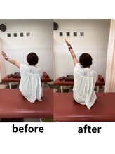 うらら整骨院/肩がこんなに上がります！