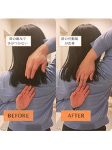 サンテリア(Santelia)/肩の症状も
