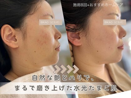 ビカオ(BIKAO)の写真