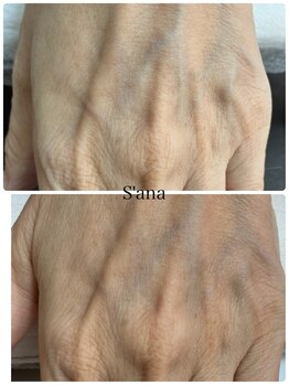 サナ 久が原 千鳥町(S’ana)/ルビッシ照射