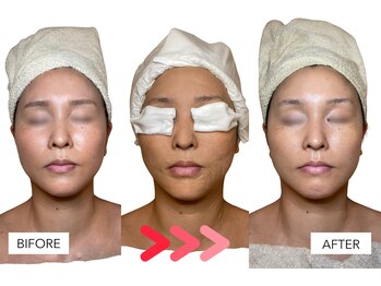 エングラッシー(en glassy)/BEFORE　AFTER　40代