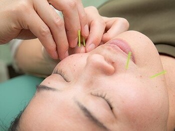 押上駅前整骨院の写真/お顔の鍼灸で美肌に！お体だけでなく、年齢とともに気になるお顔のお悩みも当院にお任せください☆