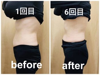 ヨサパーク フルラージュ(YOSA PARK Fleurage)